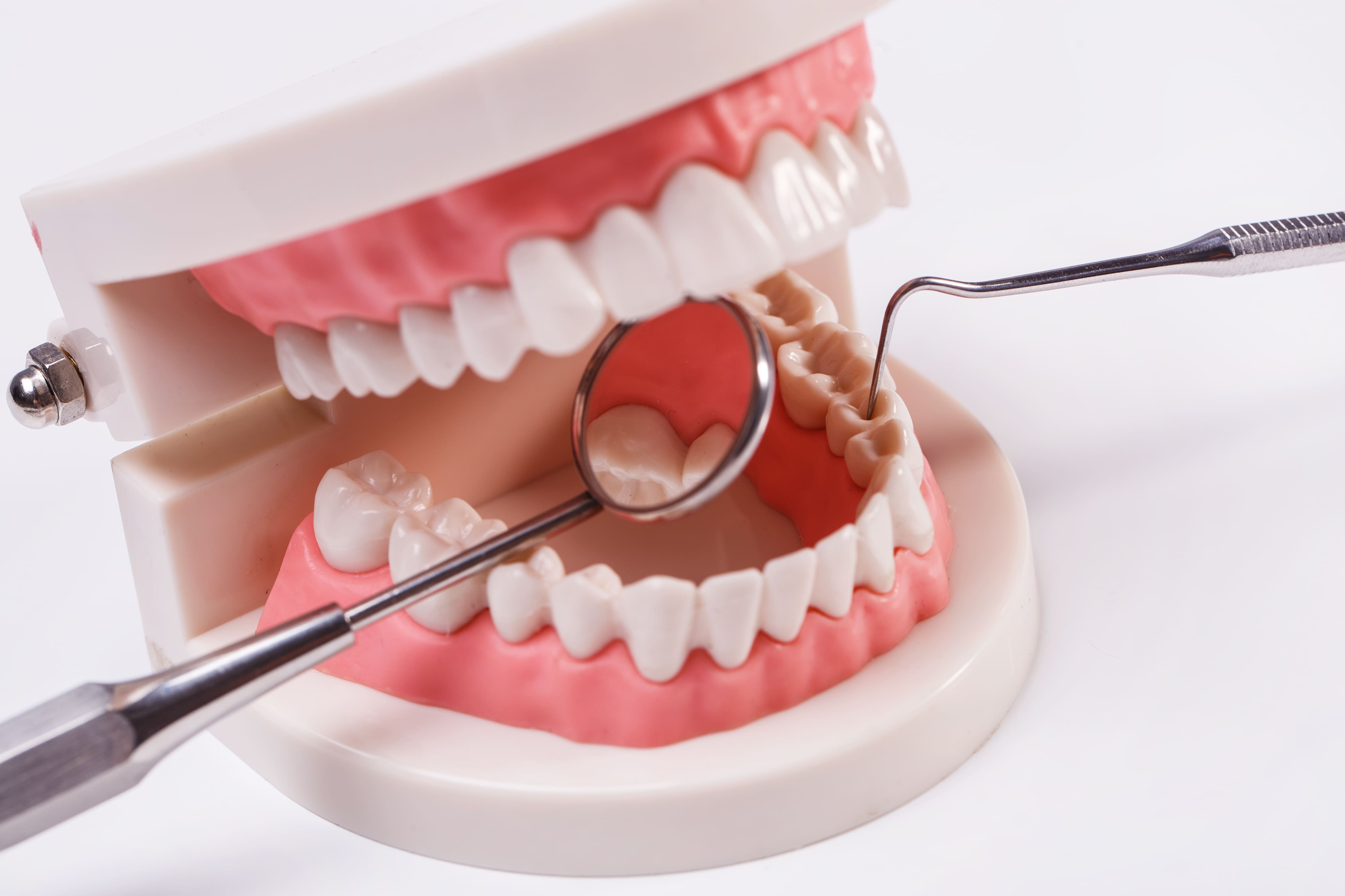 Десен системы. Льготное зубопротезирование. Одномоментная имплантация зубов. Пародонтологическая чистка зубов. Зубной камень на имплантатах.