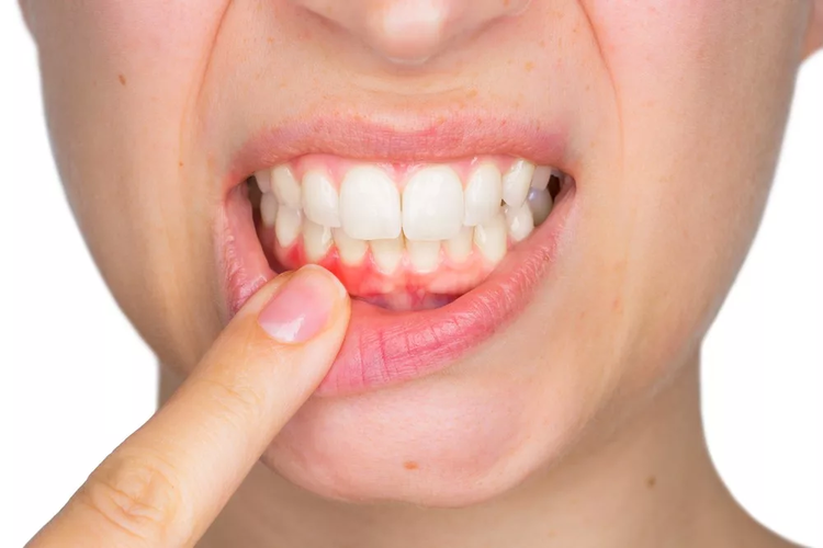 Чем полоскает рот при болезни десен thumbnail