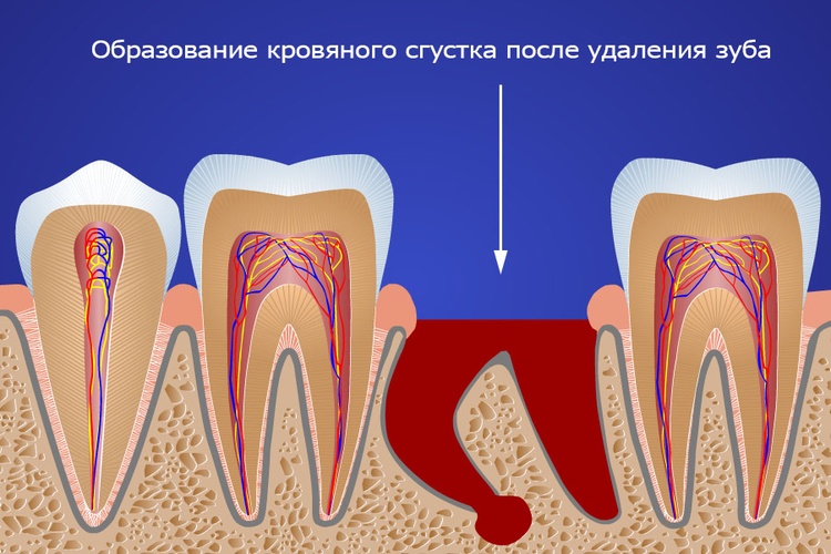 Обязательно удалять