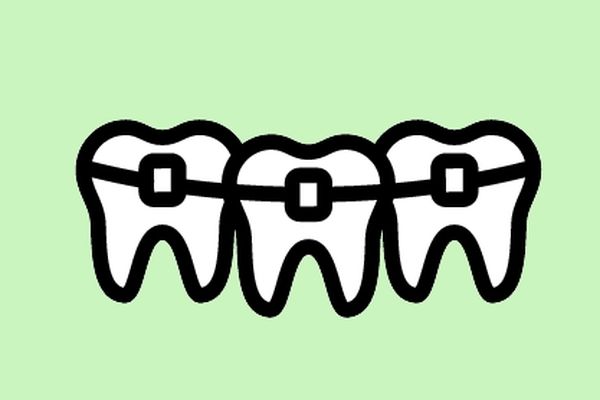 Ретейнеры для зубов: для чего нужны, как устанавливают, сколько носят