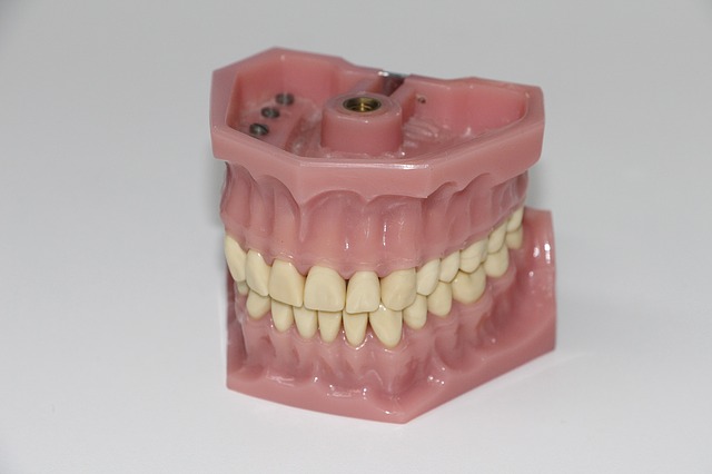 протезирование зубов виды