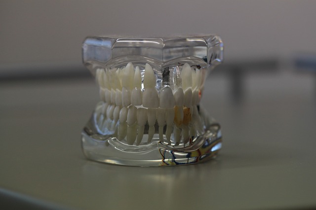 протезы протезирование зубов
