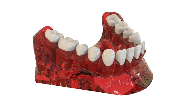 виды съемных протезов зубов