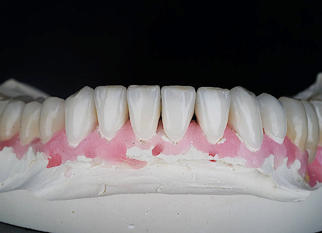 современные виниры высокотехнологичная стоматология